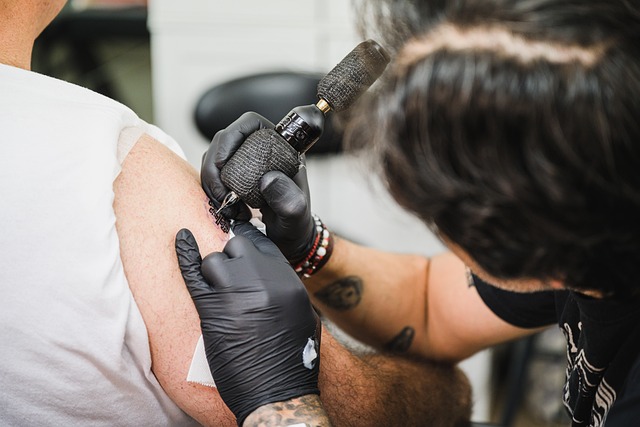 Tattoo Removal
